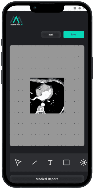 Slider image with loader